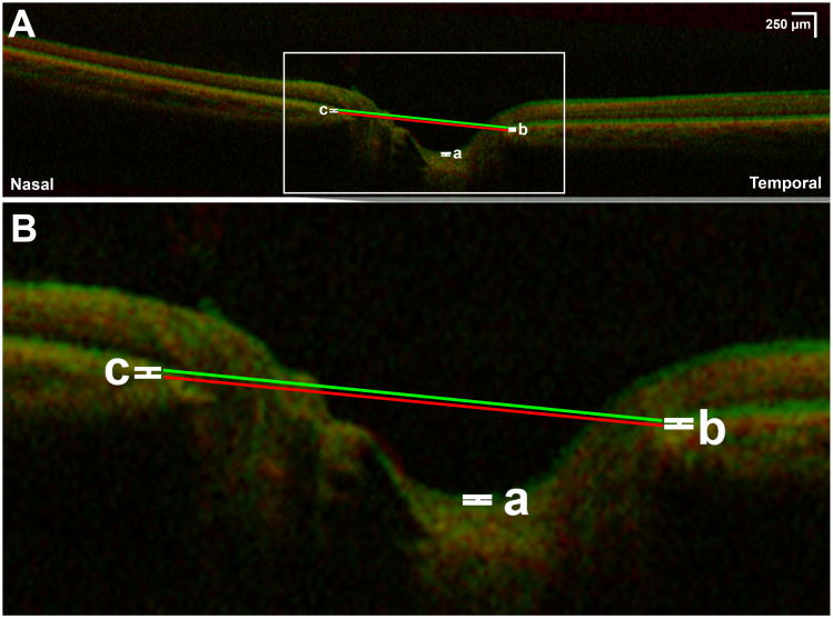 Fig. 3