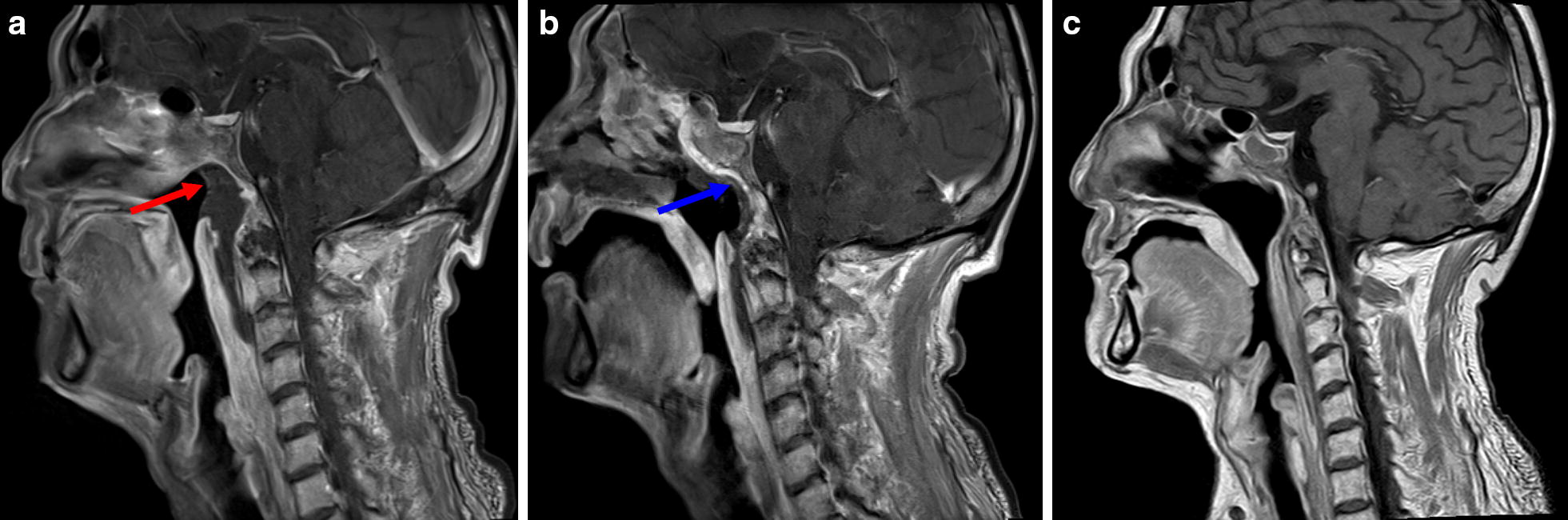 Fig. 2