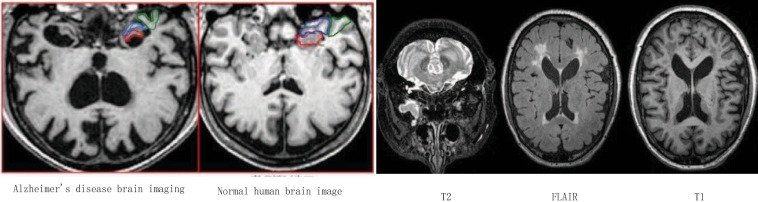 FIGURE 15