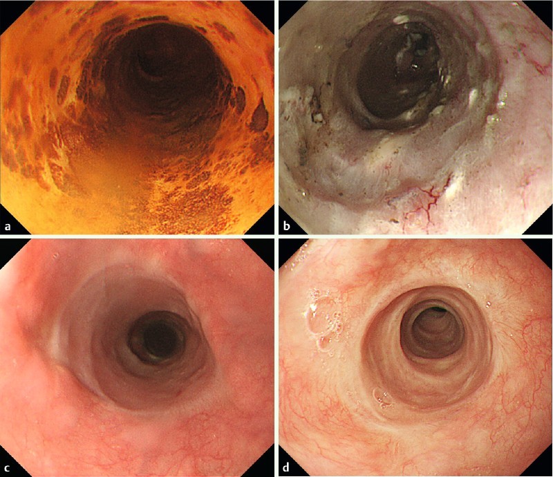 Fig. 3