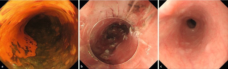 Fig. 2