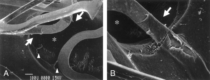 Fig 3.