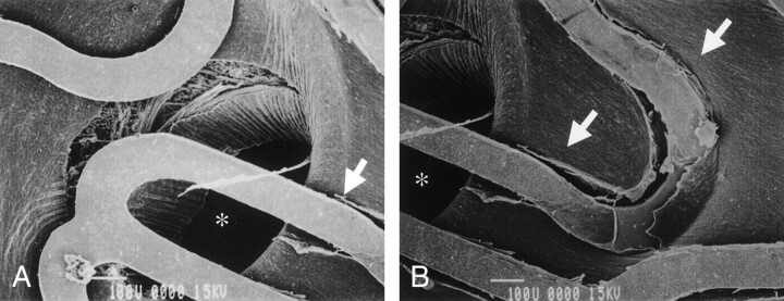 Fig 2.