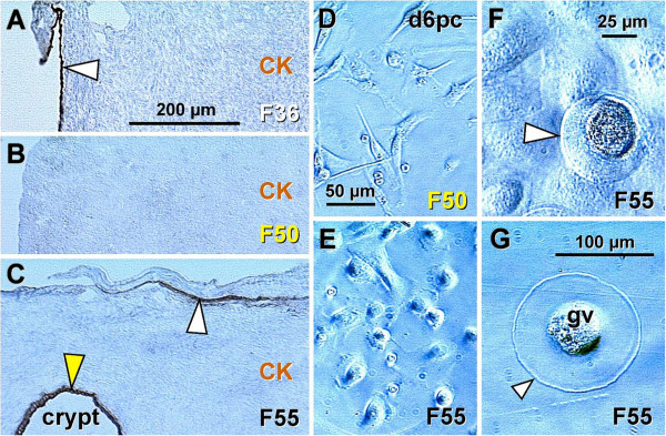 Figure 17