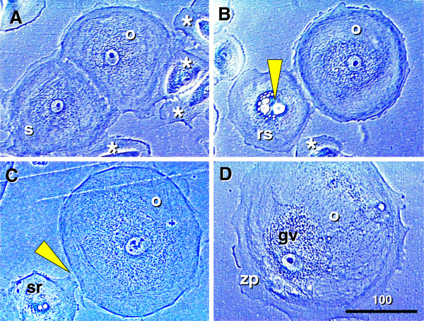 Figure 14