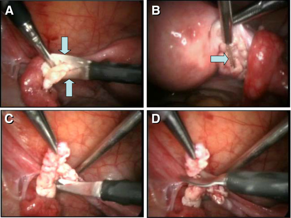 Figure 19