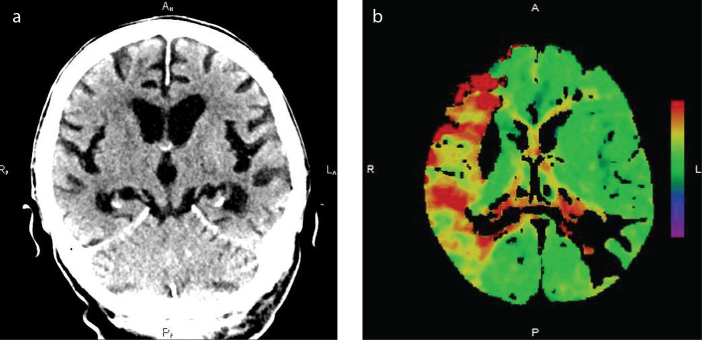 Figure 1. a, b