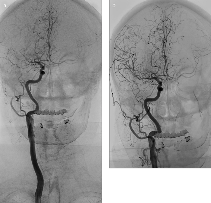 Figure 3. a, b