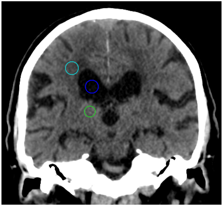 Figure 3: