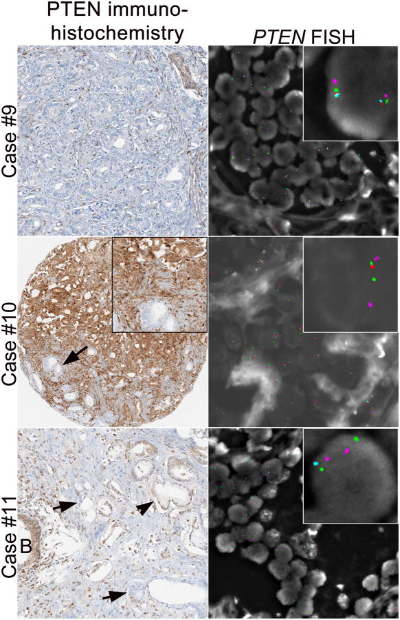 Figure 4A