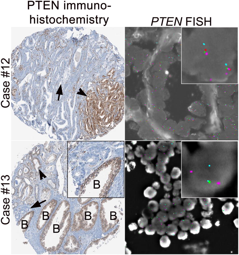 Figure 4B