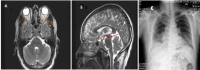 Fig. 1