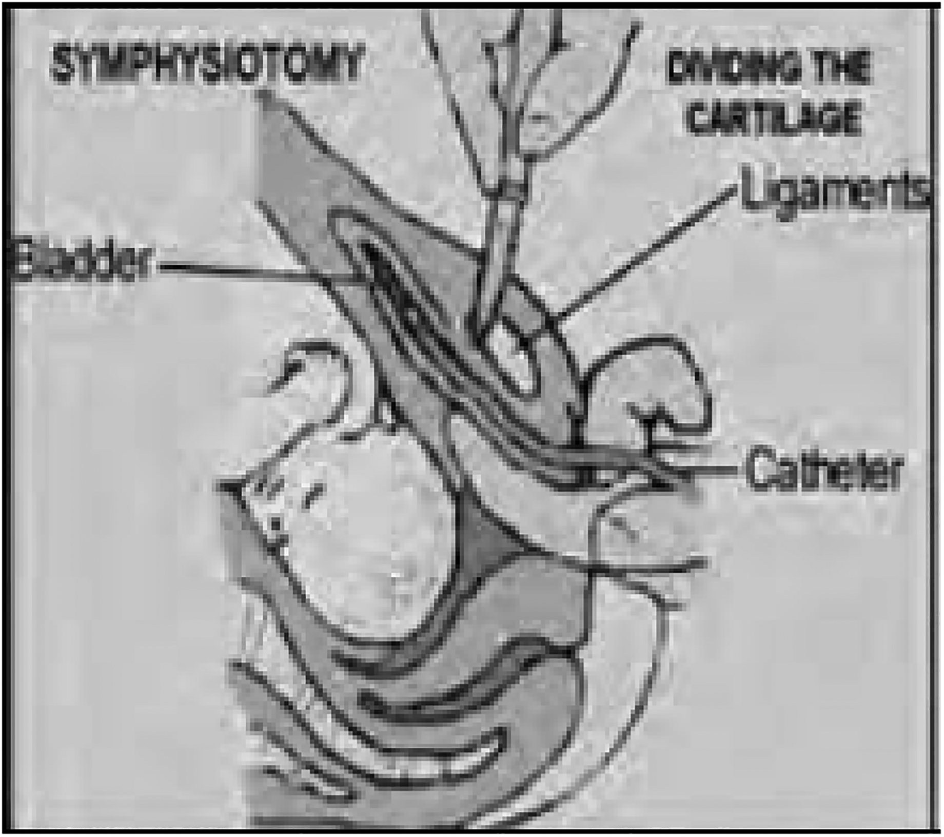 Figure 9: