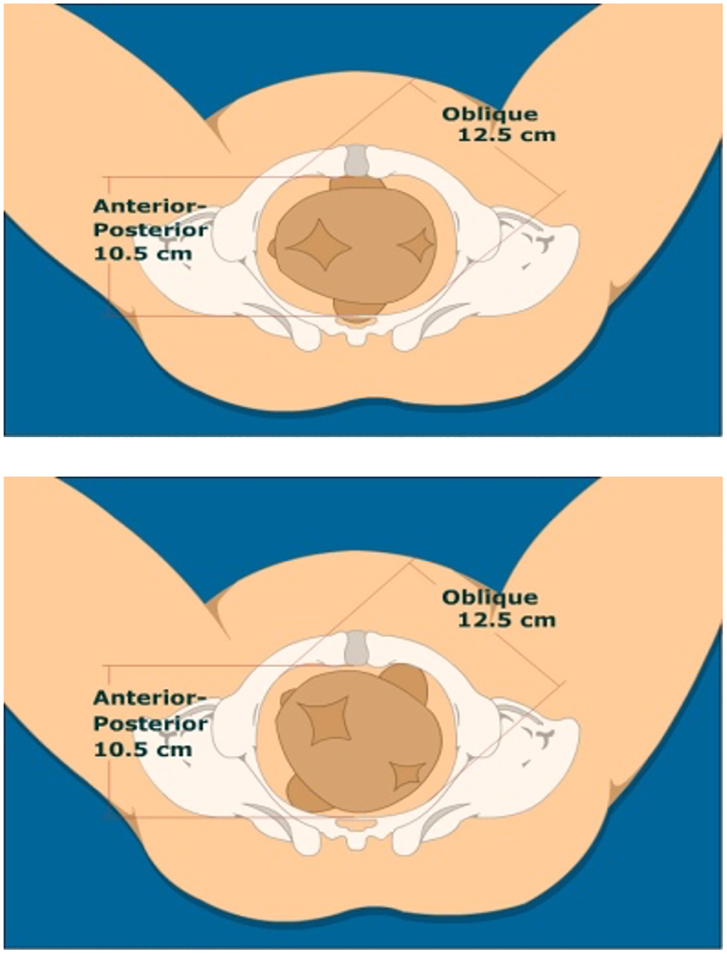 Figure 4: