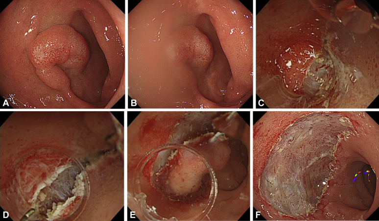 Figure 3