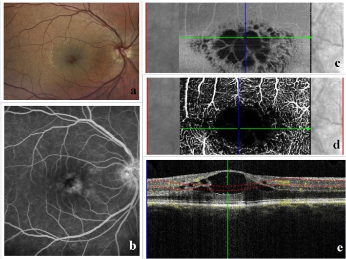 Fig. 3