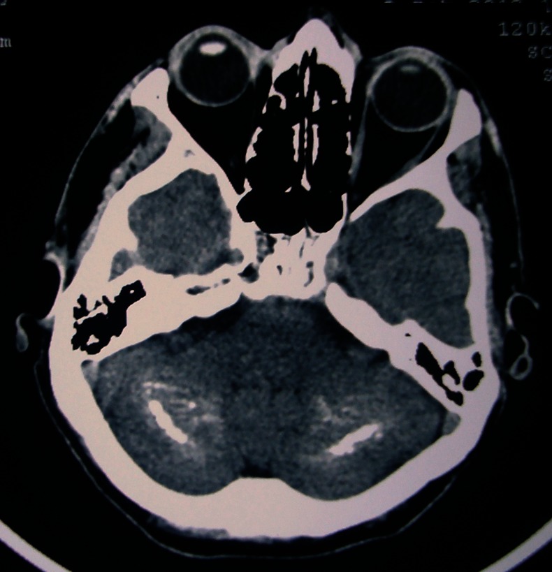 Figure 2