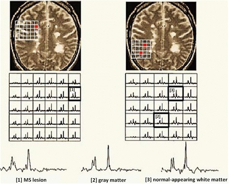 Fig. 12