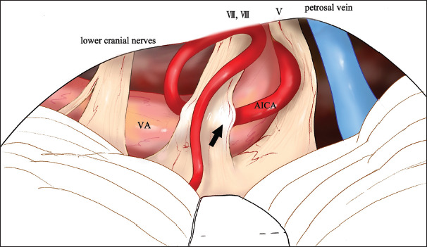 Figure 3: