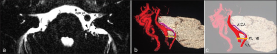 Figure 1: