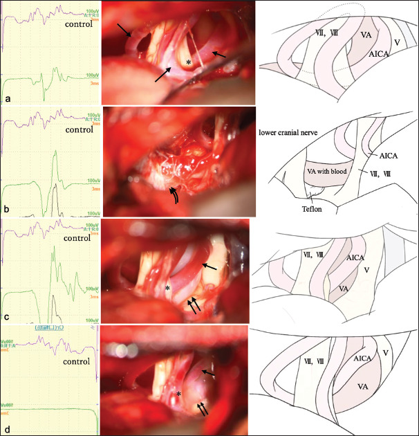 Figure 2: