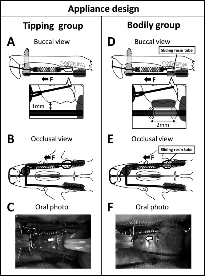 Figure 2. Appliance design. The schemes represent the orthodontic appliances used to move the maxillary left first molars mesially. (A to C) The tipping tooth movement group. (D to F) The bodily tooth movement group. (A,D) Buccal views of the appliances. (B,E) Occlusal views of the appliances. The sliding tube constructed from the self-curing resin was bonded to the occlusal surface of the maxillary first molar in the appliance for bodily tooth movement (D,E). (C,F) Intraoral images of rats. Arrows indicate the direction of the applied orthodontic force (F).