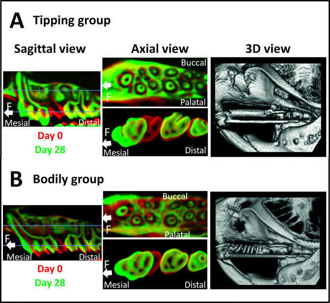 Figure 3. Micro-CT images. (A) Tipping tooth movement group. (B) Bodily tooth movement group. Superimposition of micro-CT images on days 0 and 28; sagittal views are presented on the left, and two different axial views are presented in the middle. The upper axial image displays a slice of the apical region of the tooth, whereas the lower image displays a slice of the cervical region of the tooth. Reconstructed 3D micro-CT images on day 28 are shown on the right.