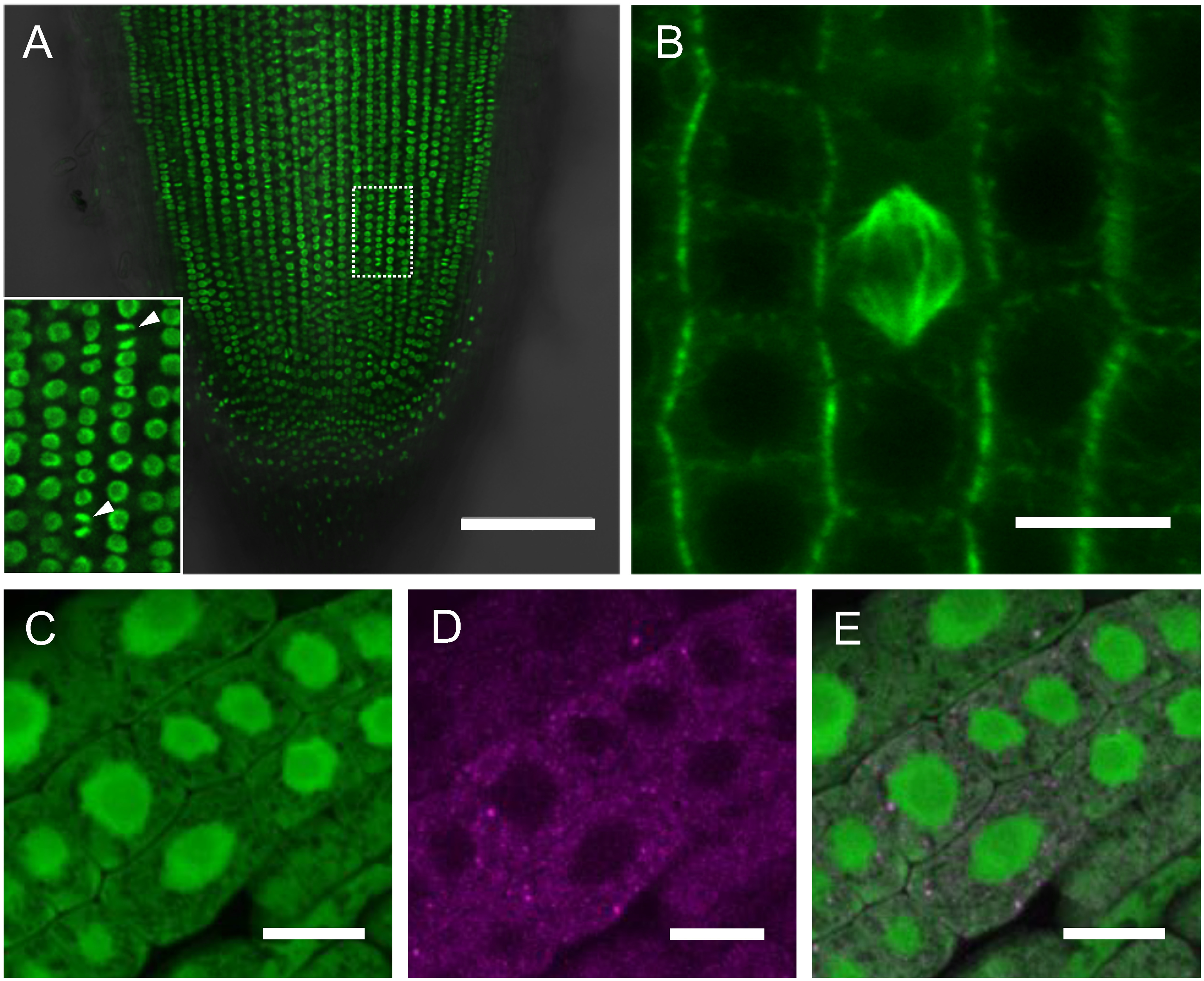 Figure 4. Examples of fluorescent protein-tagged organelle markers. (A) Nuclei marked by proUBQ:H2B-GFP in a root apex. Arrowheads in the insets indicate nuclei at mitosis. A dashed box is the area magnified in the inset. (B) Microtubules in proUBQ: GFP-AtTUB6 root epidermis. Center is a spindle structure at metaphase in mitosis. (C–D) P-bodies in root marked by proUBQ:OsDCP2-mCherry introduced in proUBQ:GFP background. Fluorescence channels are for GFP in (C), for OsDCP2-mCherry in (D). (E) is a merged image of (C) and (D). Scale bars are 100 µm in (A), 10 µm in (B) to (E).