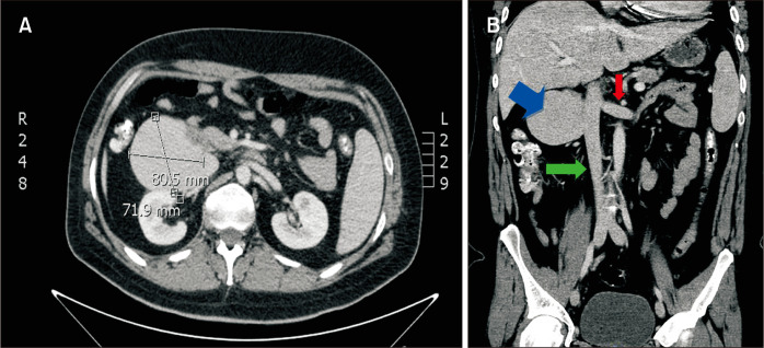 Fig. 2