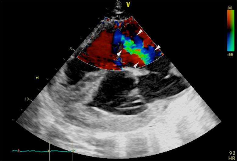 Fig. 1