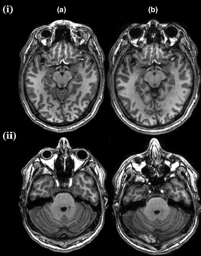  FIG. 2.