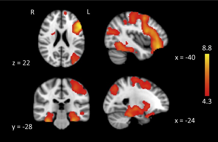 Fig. 2