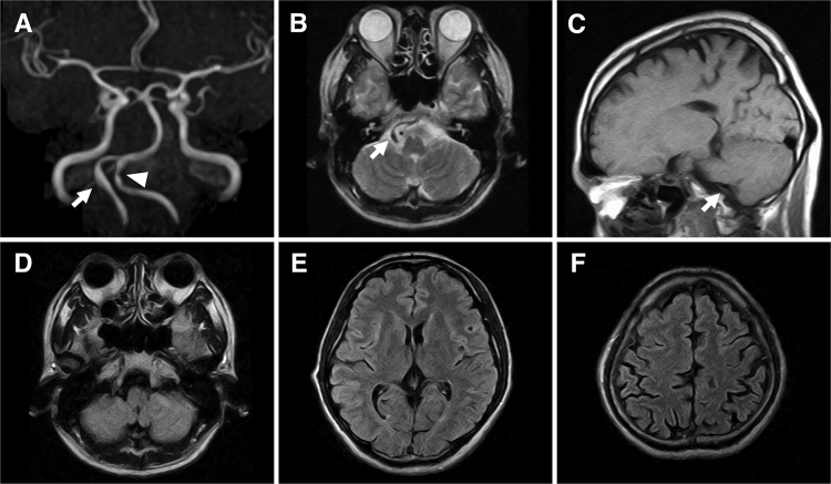 FIG. 1.