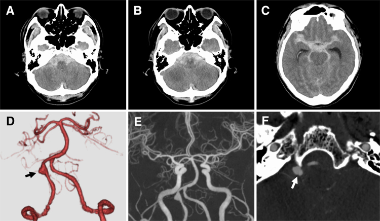 FIG. 2.