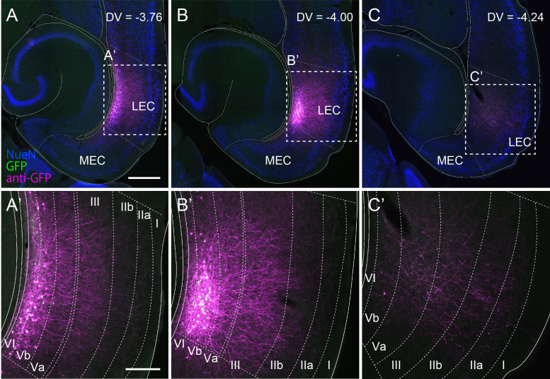 Figure 1—figure supplement 3.