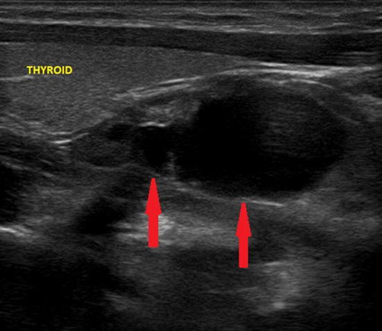 Fig. 6