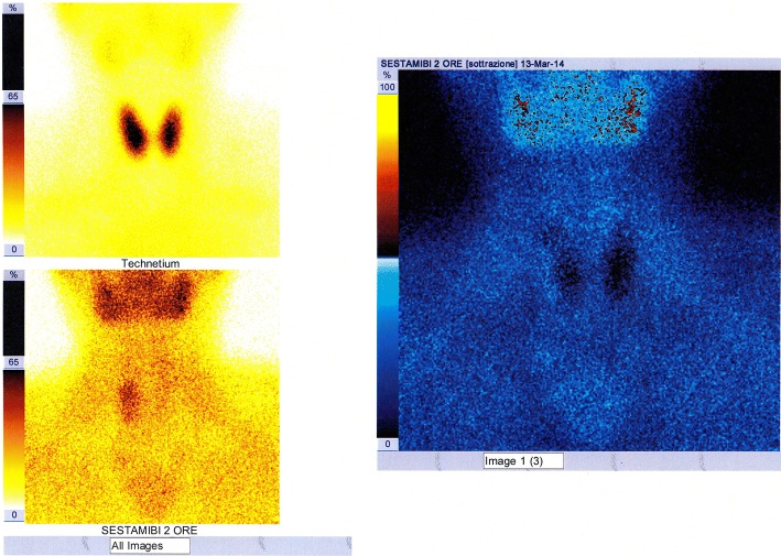 Fig. 11