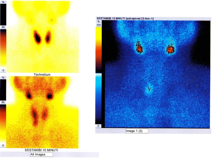 Fig. 10