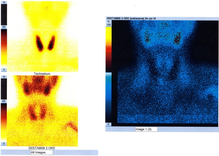 Fig. 12