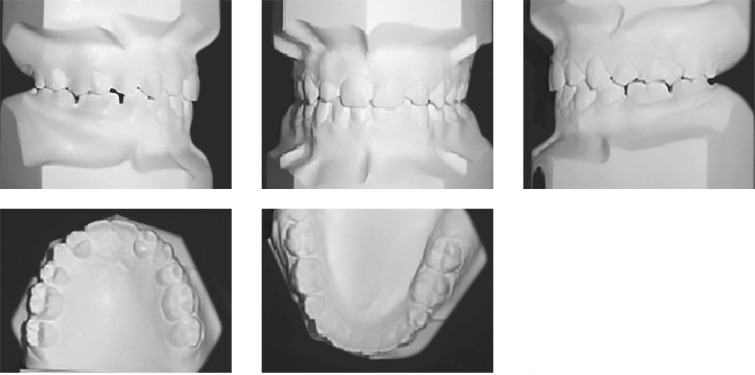 Figure 12 -