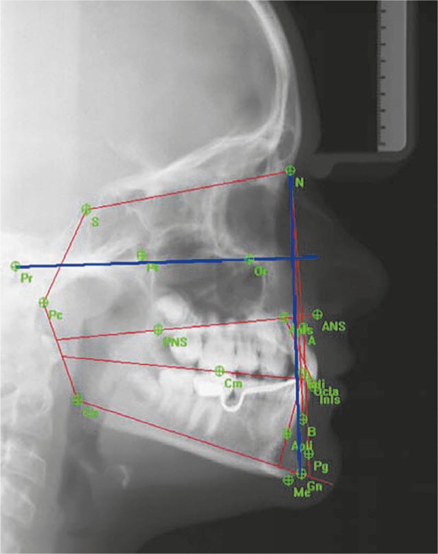 Figure 7 -