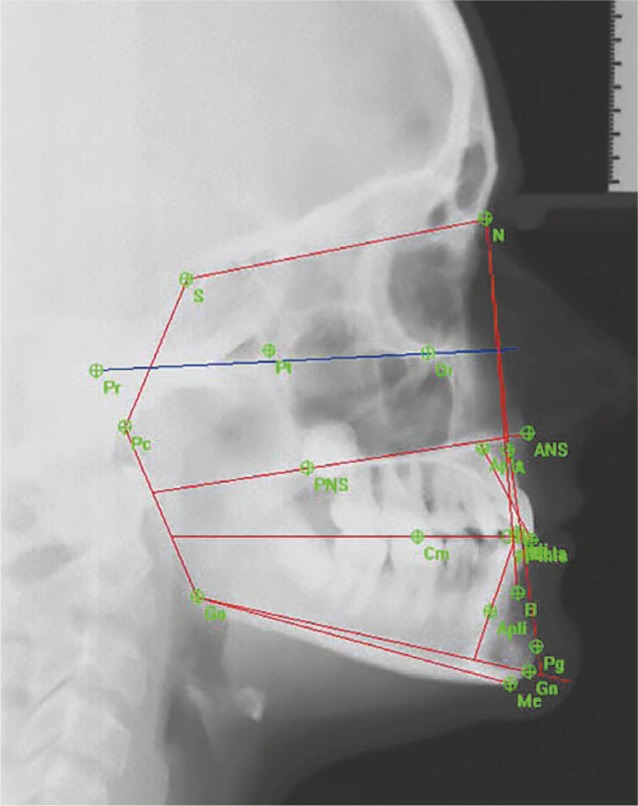 Figure 15 -