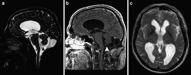 Fig. 5