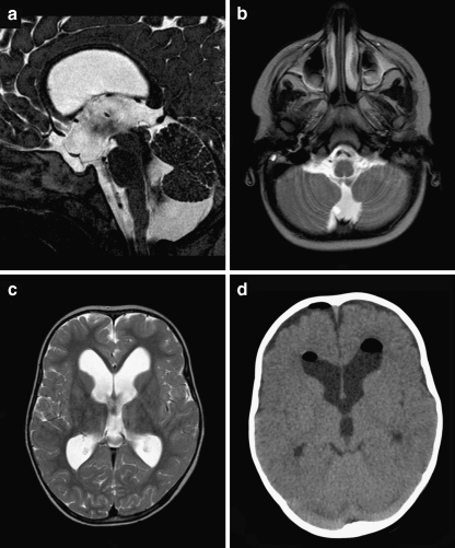 Fig. 3