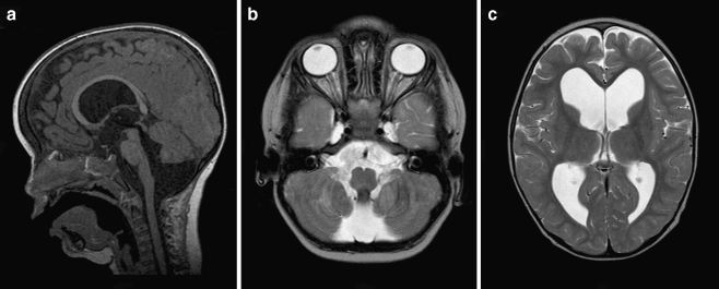 Fig. 2