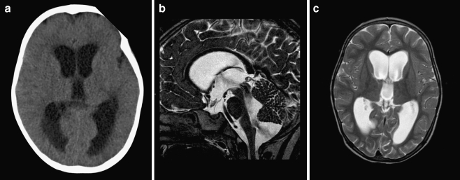 Fig. 4