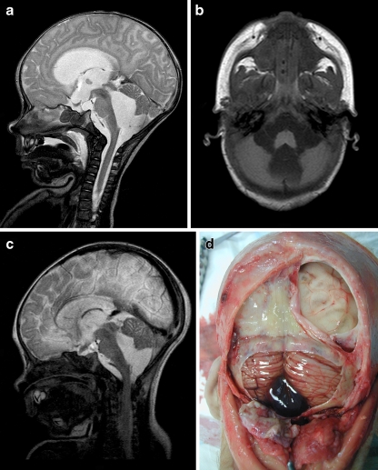 Fig. 1