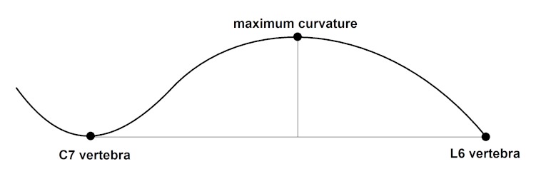 Kyphotic index (KI) was calculated as the ratio of length to depth of the thoracodorsal kyphosis. 