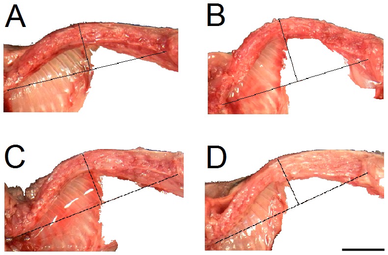 Dissections showing difference in KI.