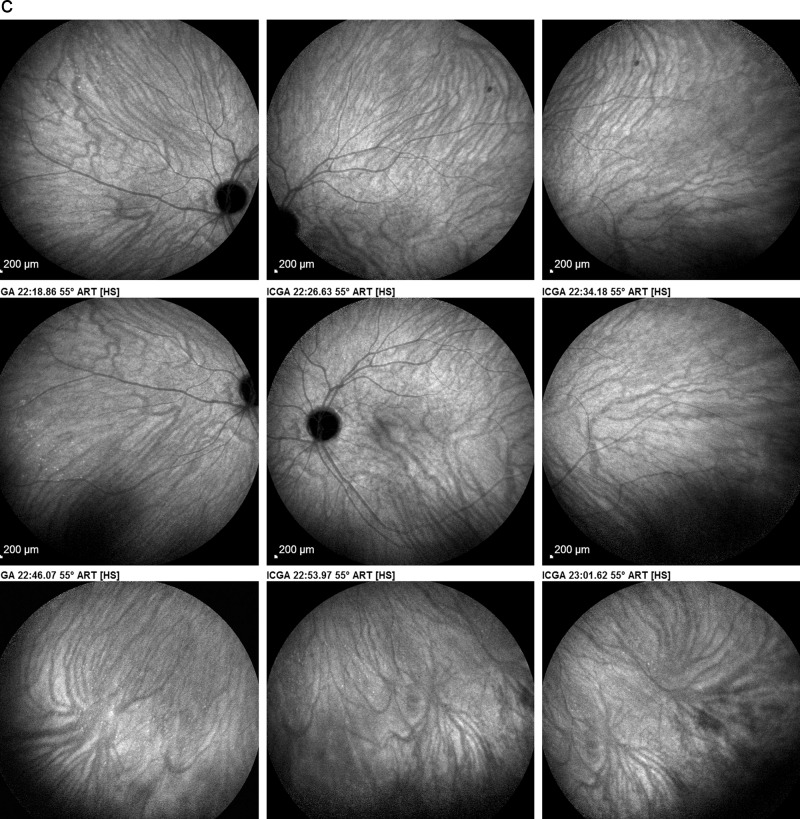 Fig. 10